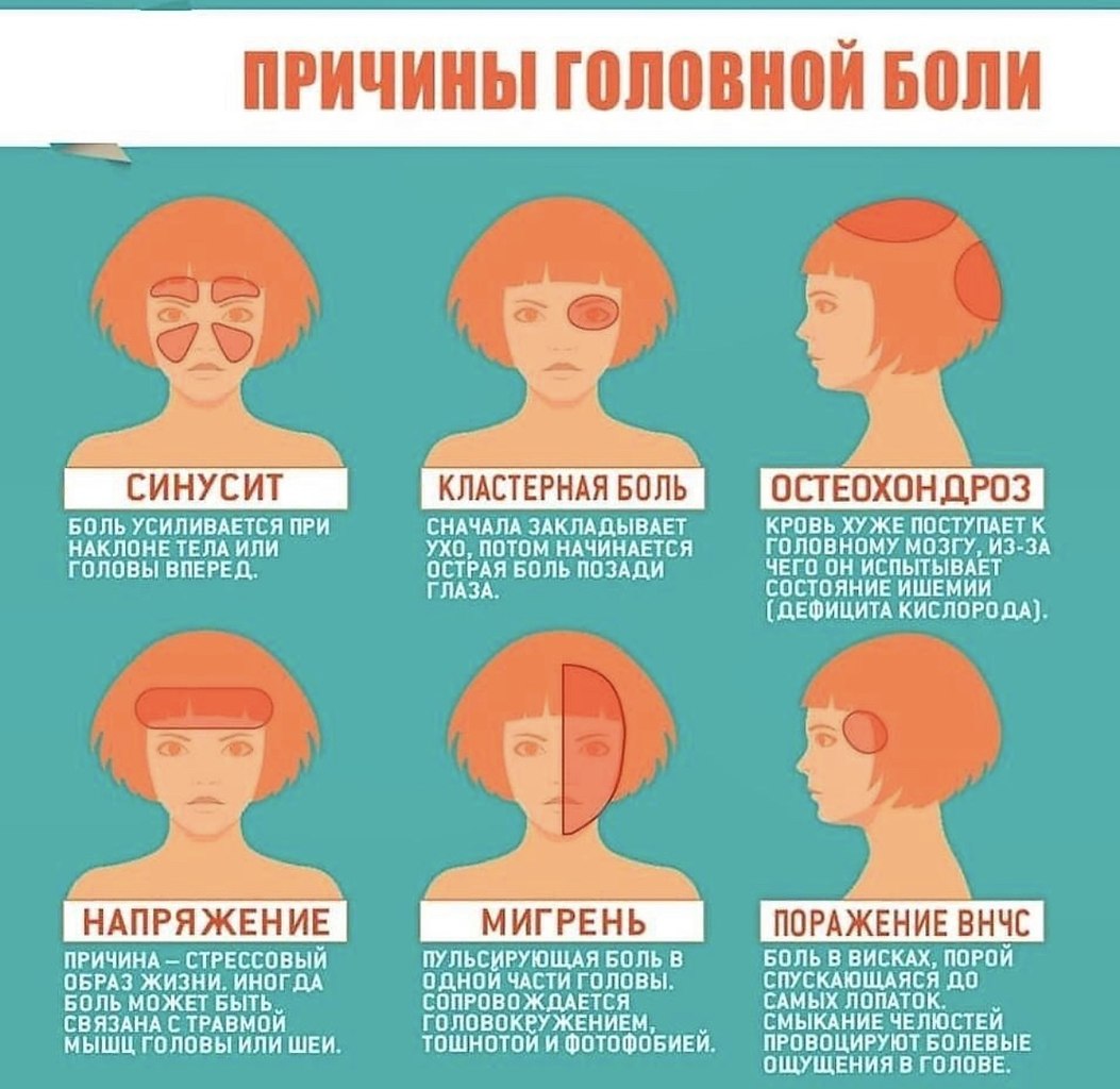 Типы головной боли