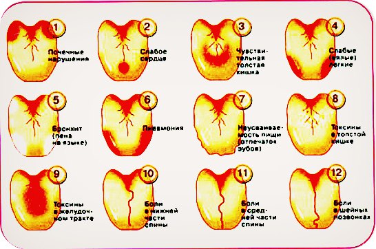 Диагноз по языку в картинках цвет