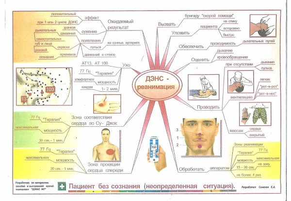 Денас в логопедии схема работы