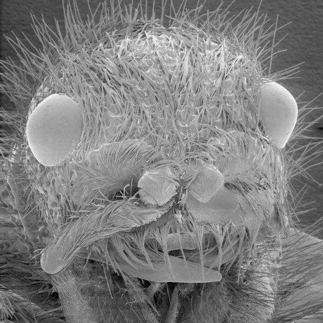 Вша человеческая фото как выглядит под микроскопом