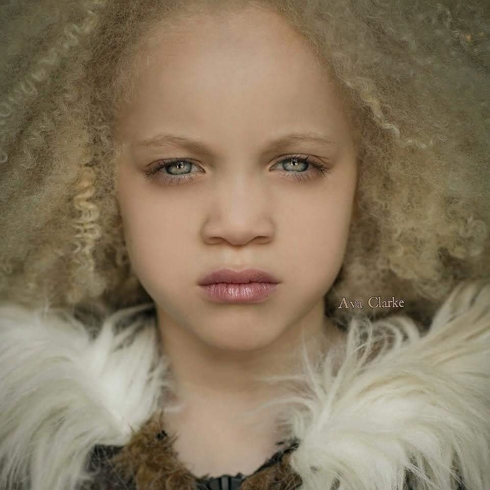 Ава Кларк — афроамериканка-альбинос.