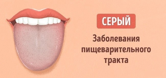 Рисунок языка в норме