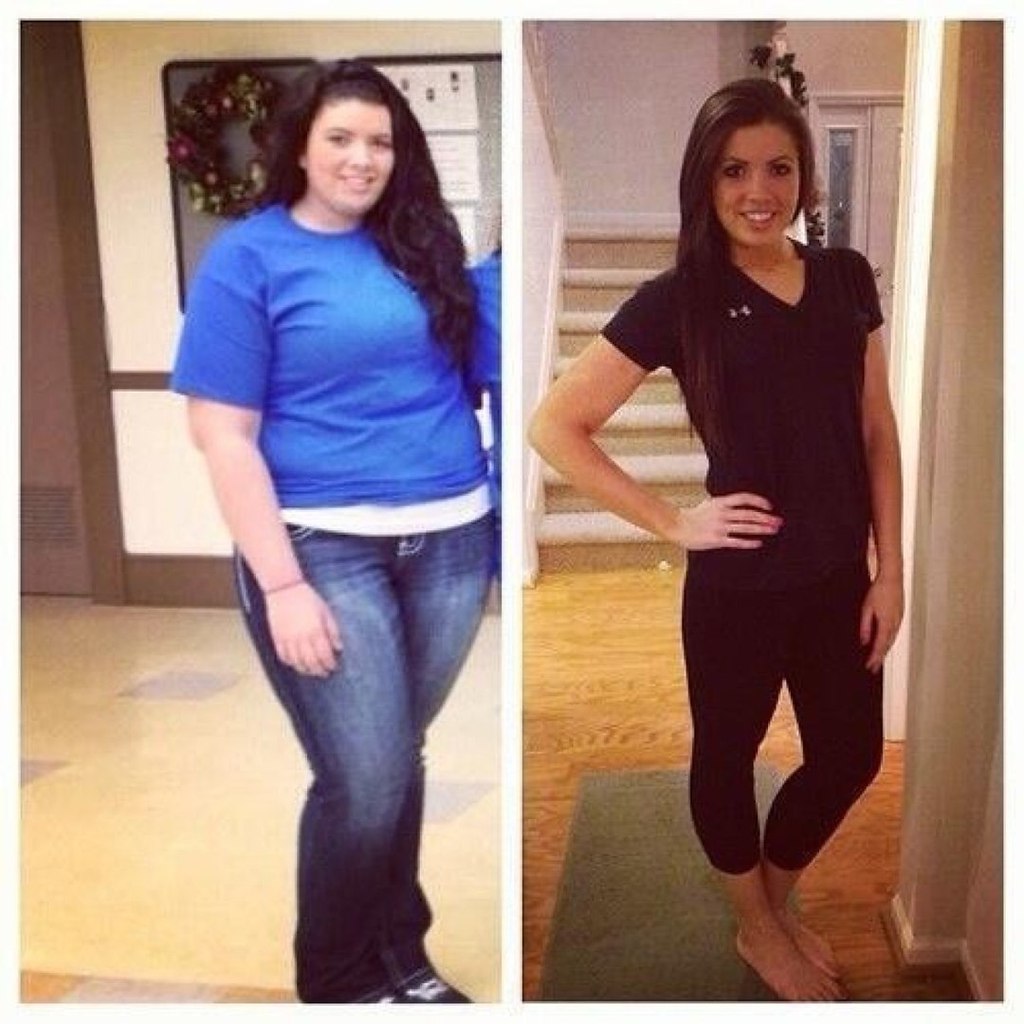До и после похудения на 40 кг