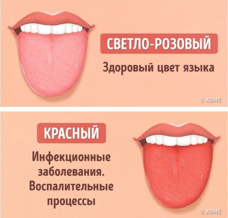 Болезни по языку схема на лету и цветам