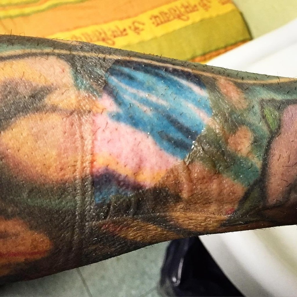 татуировка на ожог руку