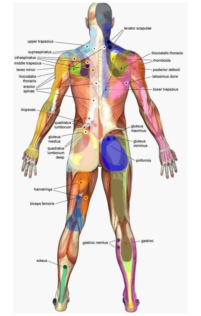 Карта точек боли в теле и точек напряжения мышц триггеры