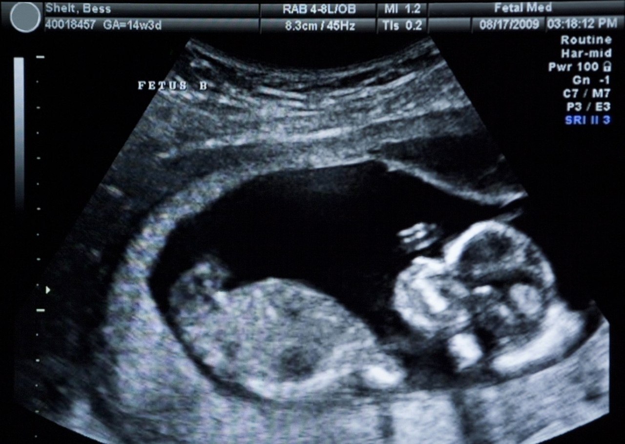 Беременность 13 недель развитие плода и ощущения женщины фото