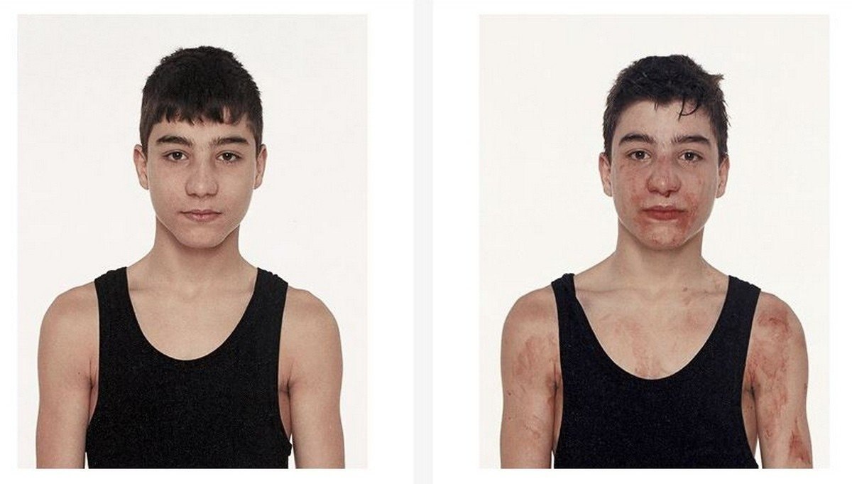Ваня ржевский до похудения фото до и после