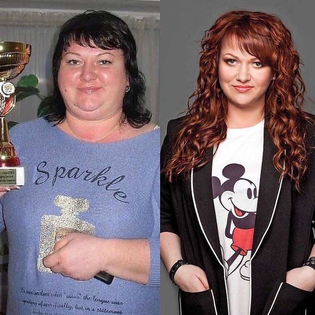 похудевшая картункова фото до и после