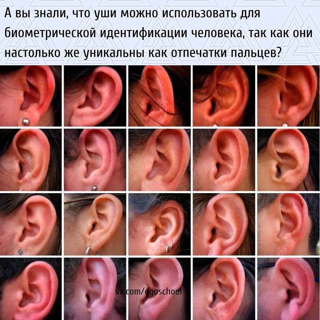 Почему уши разные