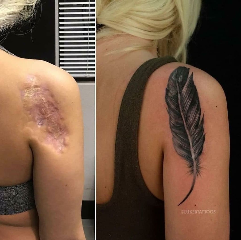 Перекрытие шрамов татуировкой на плече