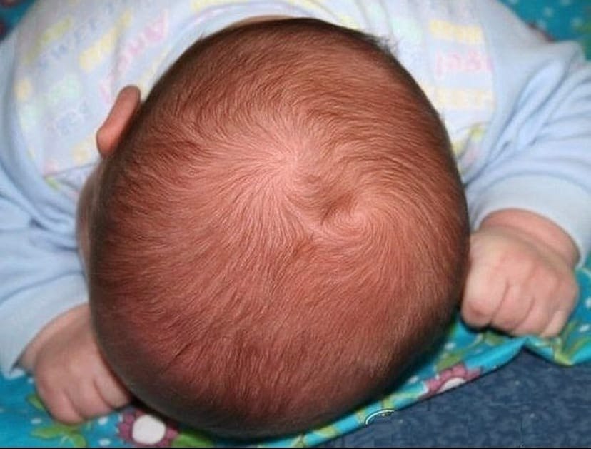 Ребенок постоянно крутит волосы на голове с чем это связано