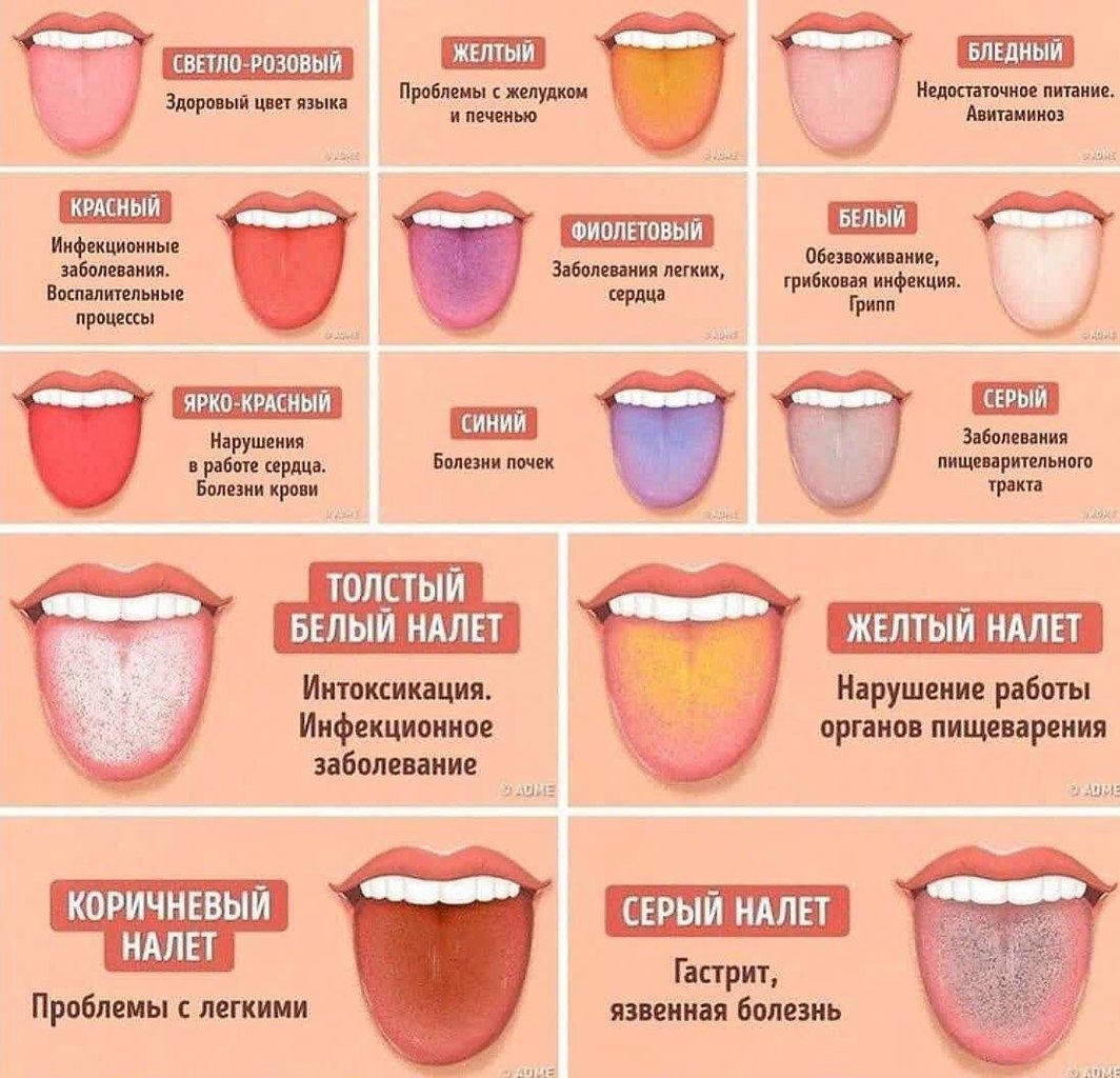 пятна на языке фото