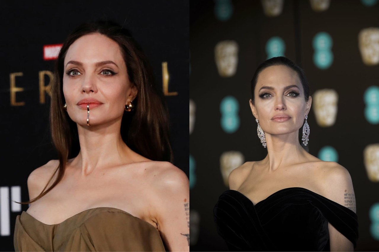 Анджелина Джоли пластика до и после