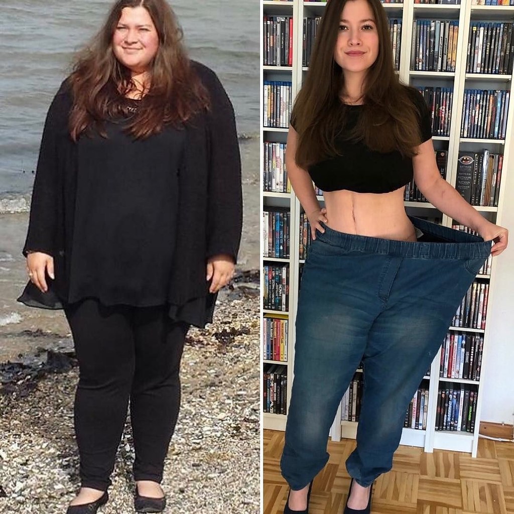 Девушки после похудения фото до и после