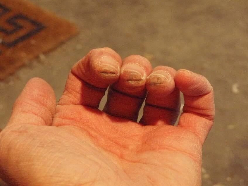 Пальцы после игры