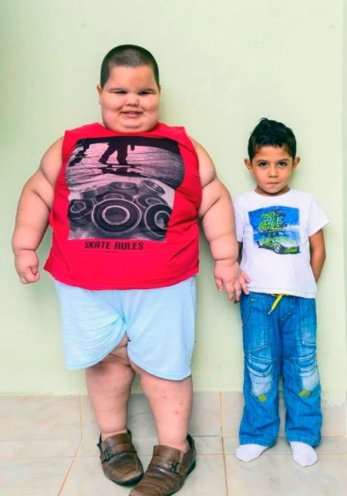 Толстые дети 10 лет фото