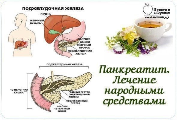 ПАНКРЕАТИТ. СИМПТОМЫ И ЛЕЧЕНИЕ ПАНКРЕАТИТА НАРОДНЫМИ СРЕДСТВАМИ ...