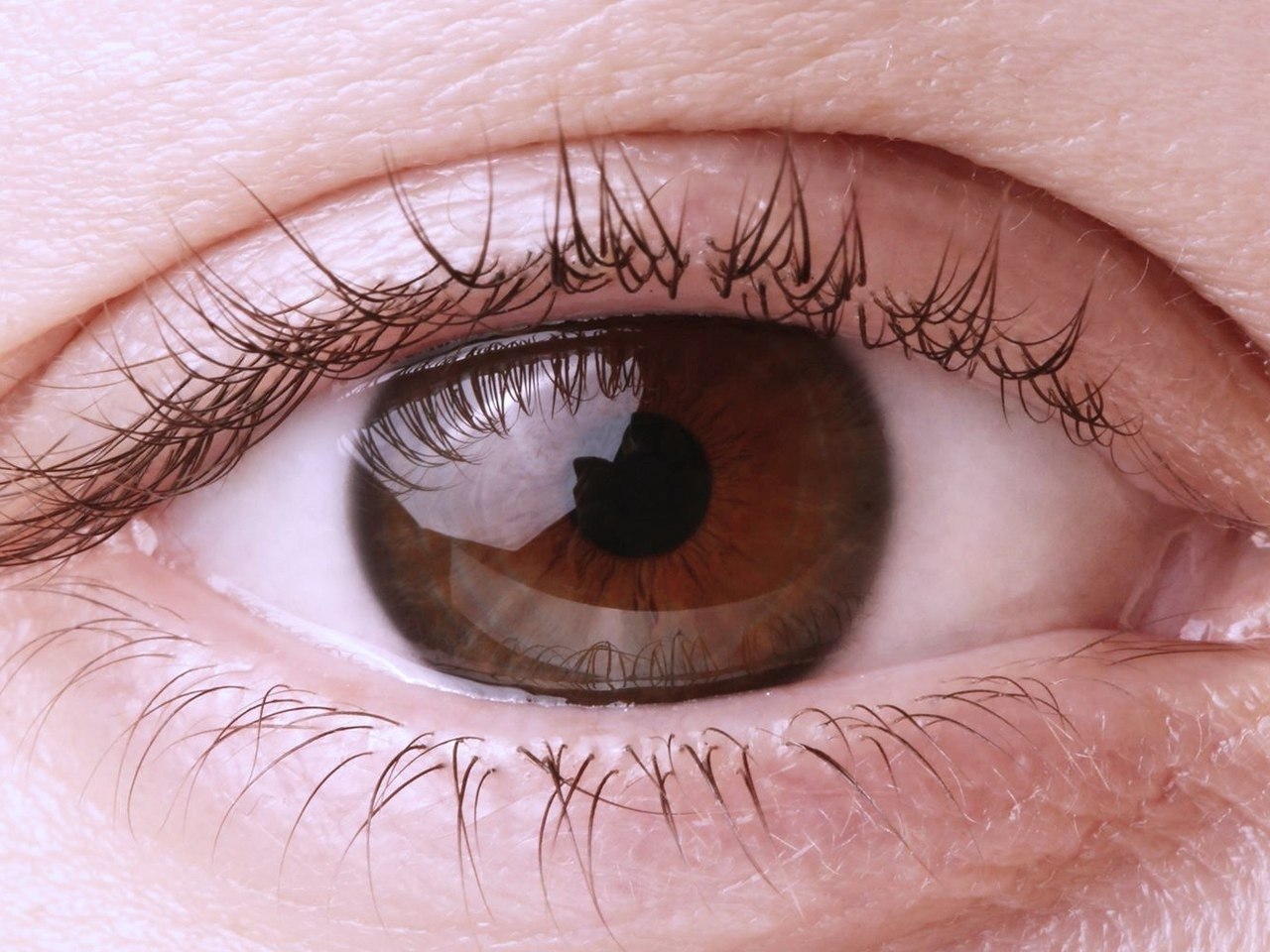 У кого квадратные зрачки. Поликория аномалия глаз. Карий цвет глаз.