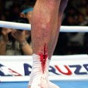 ���� �����, �����������, 31 ��� - ��������� 10 �������� 2011 � ������ �������