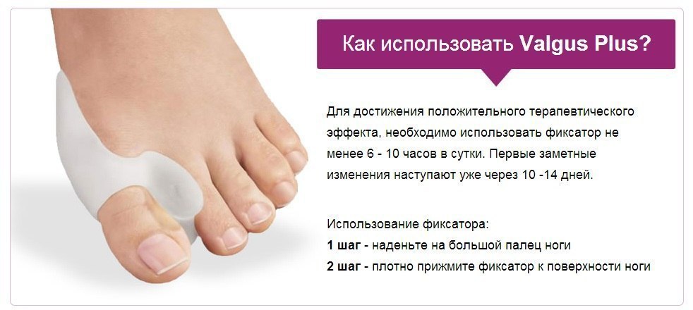 Фиксаторы вальгус про. Фиксатор "valgus Pro" (вальгус про). Гелевый фиксатор valgus Pro. Корректор для большого пальца valgus Pro (вальгус про). Вальгус от косточки на большом пальце.