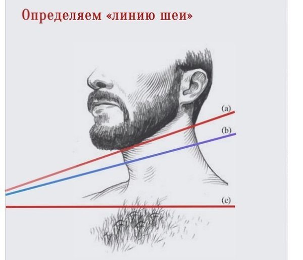 Dr. Jean Devroye - HTS Clinic / 1011 FUE / Beard reconstruction Bellicapelli For