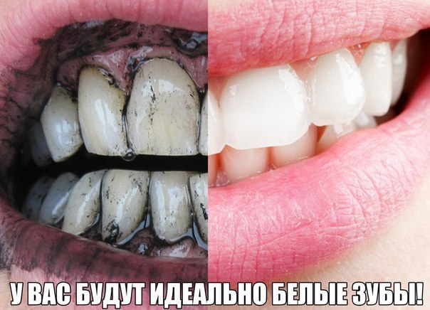     !   !   !   ...