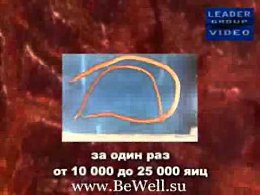 Паразиты внутри нас