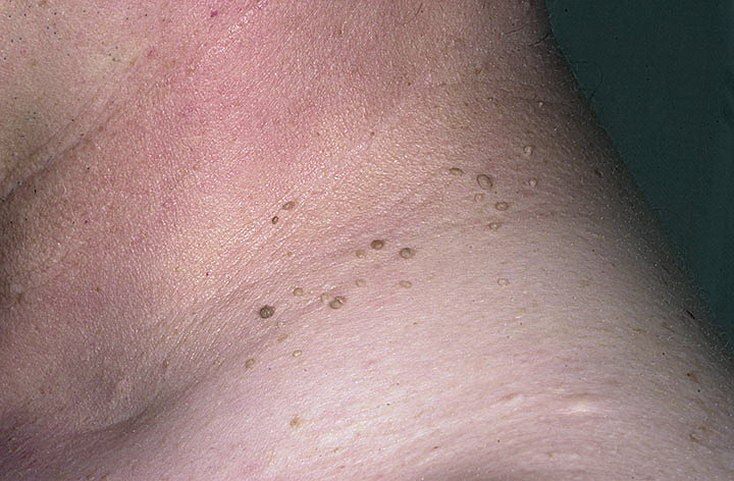    ?     72%.    .  ...