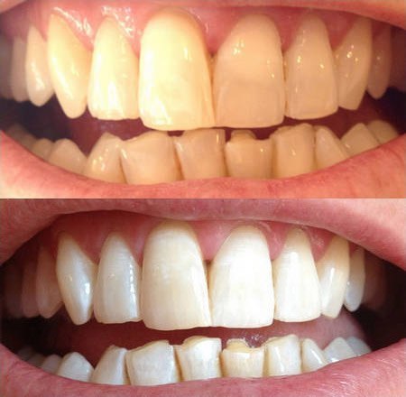 ��� � ���! ������ ����������� ����� �� �����������! - ��� ������, ����� ������� ������ �� ���� - ...