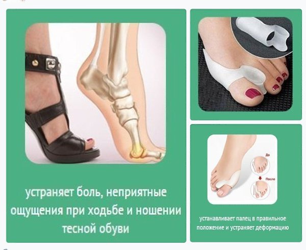 ФИКСАТОР БОЛЬШОГО ПАЛЬЦА VALGUS PRO – ОДНО РЕШЕНИЕ ТРЕХ ПРОБЛЕМ.3АКАЗАТЬ МОЖНО ТУТ: ...