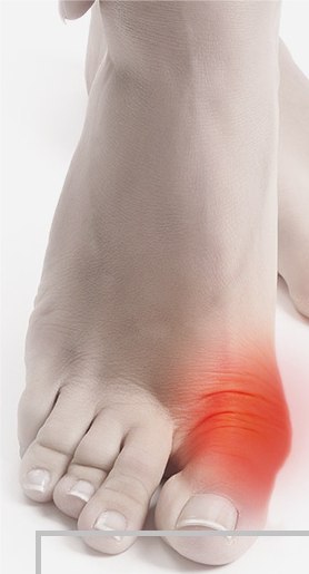 Valgus Plus -    .        1   ...