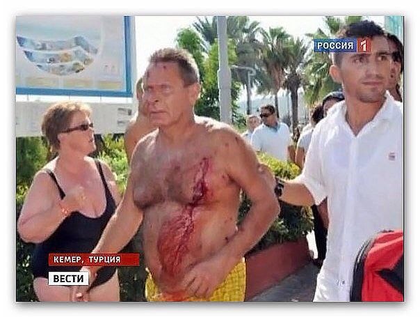 В одном из турецких отелей в курортном городке Кемер произошёл настоящий бой между украинскими и ...