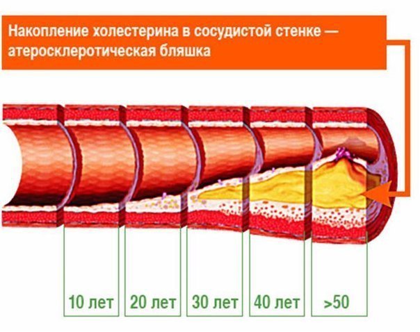 Проверенные поколениями народные средства. 1. Сосна и шиповник. - Возьмите сосновые веточки, ...