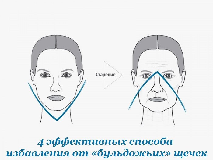 4 эффективных способа избавления от «бульдожьих» щечек.Символ молодости женщины — вовсе не лицо или ...