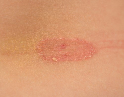 ��������� �������� ����: ��� �� ��������? ��������� �������� � ��� ����� ���������� �������, ���� ... - 2