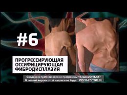 10 Ужасных ПАРАЗИТОВ, которые могут жить в тебе