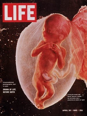 В первом номере знаменитого журнала Life, вышедшем в 1936 году, был помещён снимок новорожденного по ...