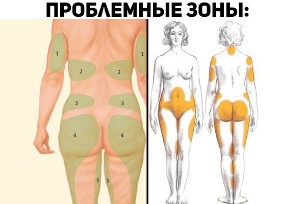 Проблемные зоны женской фигуры названия на рисунке