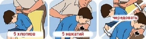 Что делать если ребенок подавился? Запомни действия в опасной ситуации! Забирай на стену, возможно, ... - 2