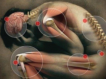 Захрустело? Хруст в суставах для многих людей, а особенно для спортсменов стал уже обыденным ...
