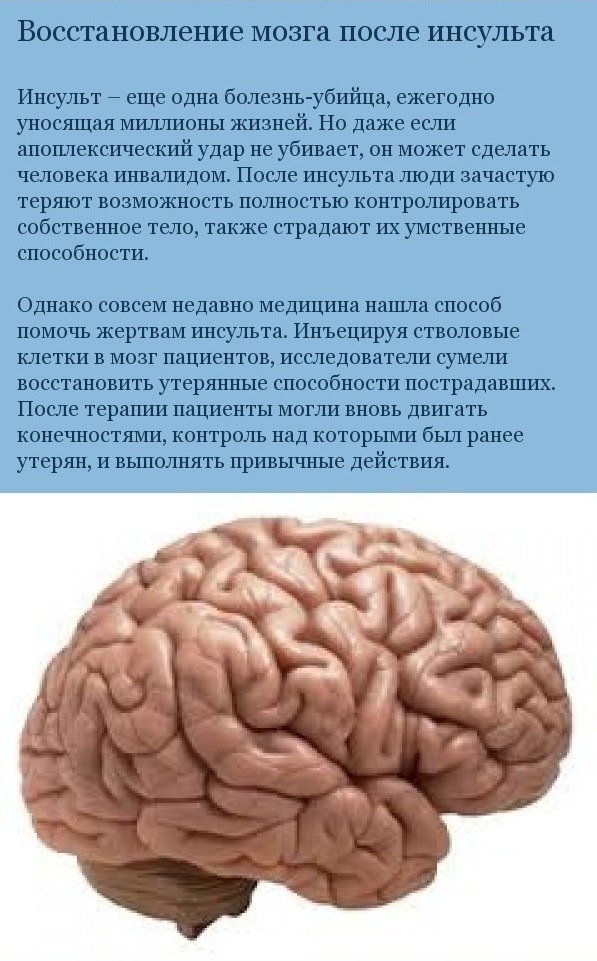 Регенерация мозга. Как восстановить мозг после инсульта.