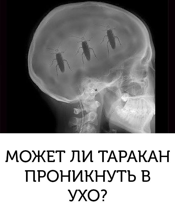 Мозги попал. Тараканы в голове рентген. Тараканы в голове рентгеновский снимок. Снимок головы прикол.