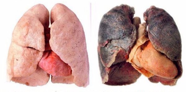 Эксперты показали шокирующую разницу между легкими курильщика и некурильщика (фото и видео)
