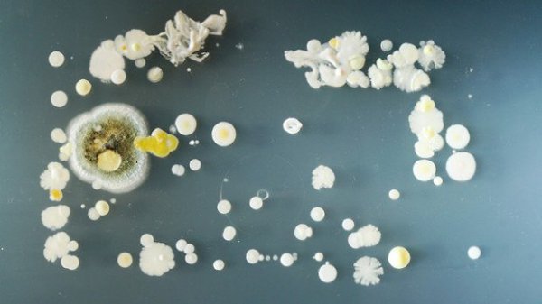 Какую заразу может вам подарить мобильный телефон.Будущие пресловутые британские ученые — студенты ... - 5