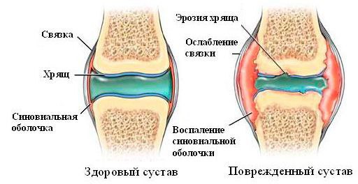 Лучшие рецепты для очищения суставов.Рецепт №1Регулярное употребление вареного риса очень хорошо ...