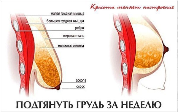 Подтяжка Груди Фото До И После