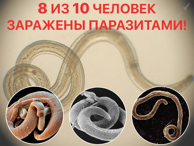 КАК ИЗБАВИТЬСЯ ОТ ПАРАЗИТОВ, КОТОРЫЕ ЖИВУТ ПРАКТИЧЕСКИ В КАЖДОМ ...