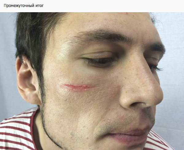 Работа в кино или маленькие хитрости гриммерного дела. Часть 2. - 8