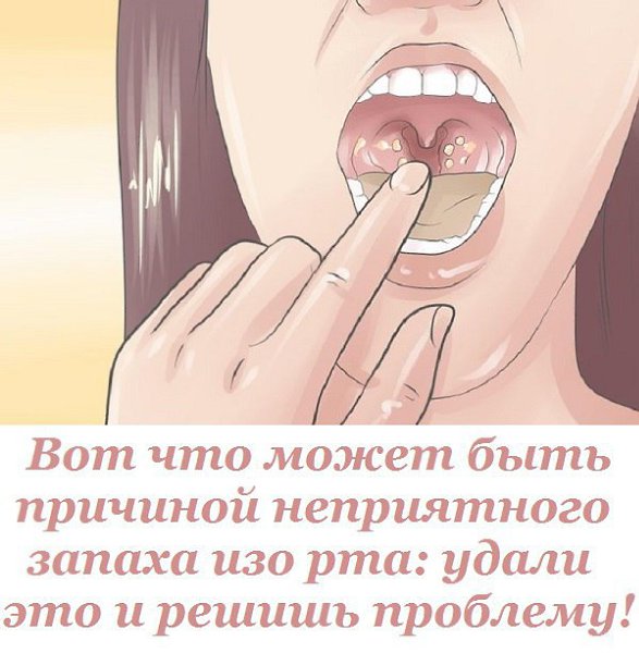 Почему жгет рот